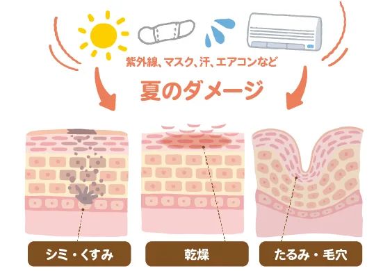 太陽やマスク、汗、エアコンの影響を表すイラストの下に、夏のダメージによる「シミ・くすみ」「乾燥」「たるみ・毛穴」の状態を示した3種類の肌断面が並ぶ、エイジングケアの解説図です。