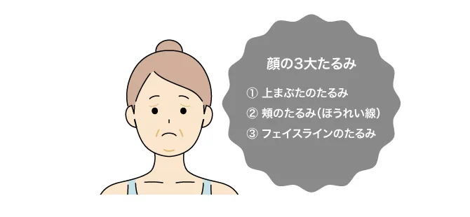 髪をまとめた女性の正面イラストの横に、上まぶたと頬、フェイスラインを挙げた「顔の3大たるみ」と書かれています。
