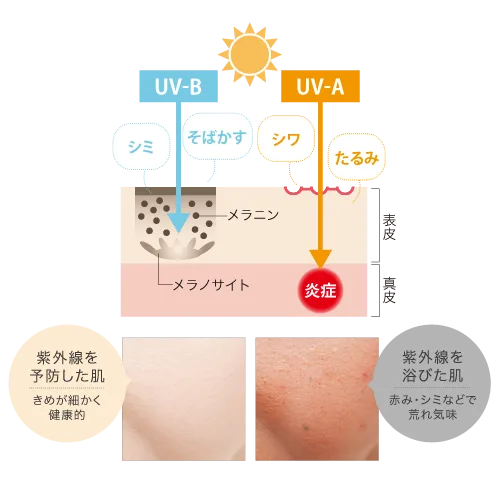 太陽から肌断面へ伸びるUV-BとUV-Aの矢印が、シミ、そばかす、シワ、たるみ、炎症への影響を示しています。下部に紫外線を予防したきめ細かく健康的な肌と、紫外線を浴びて赤みやシミが現れた肌の比較写真が並ぶ解説図です。