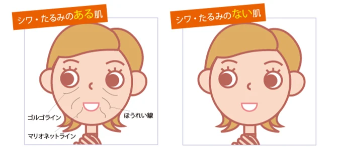 白い背景にほうれい線やマリオネットラインがある顔と滑らかな顔のイラストが並び、「シワ・たるみのある肌」と「シワ・たるみのない肌」を比較しています。