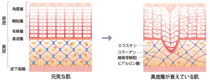 白い背景に元気な肌と真皮層が衰えた肌の断面図が並び、シワ＆たるみに関わるコラーゲンやエラスチン、ヒアルロン酸の状態を比較しています。